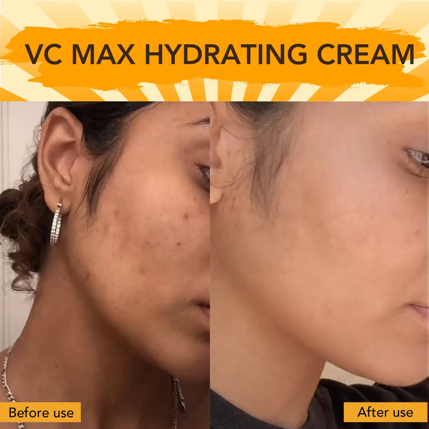 Vitamin C Brightening Face Cream
