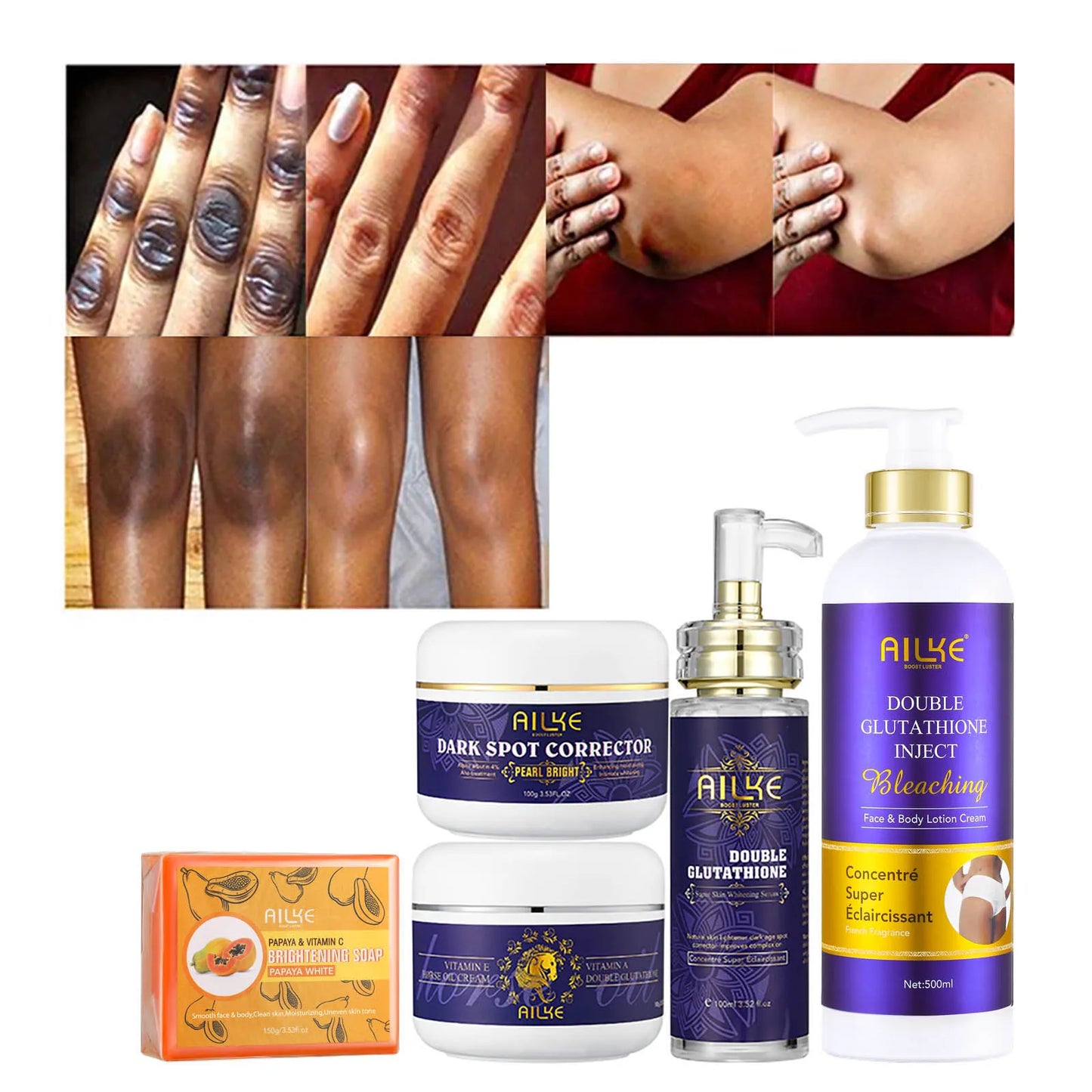 Super Bleaching And Dark Spot Remove Body Lotion