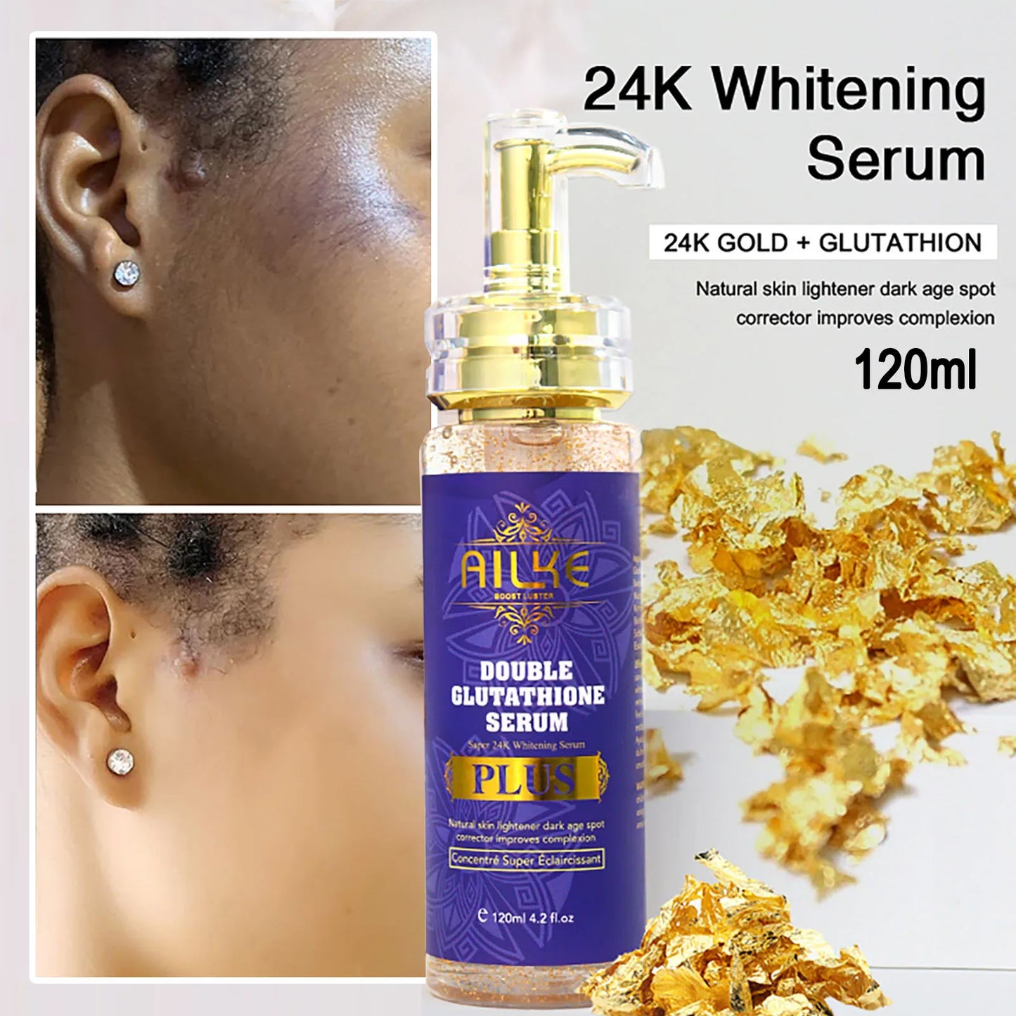 Dark Spot Remover For Face And Body