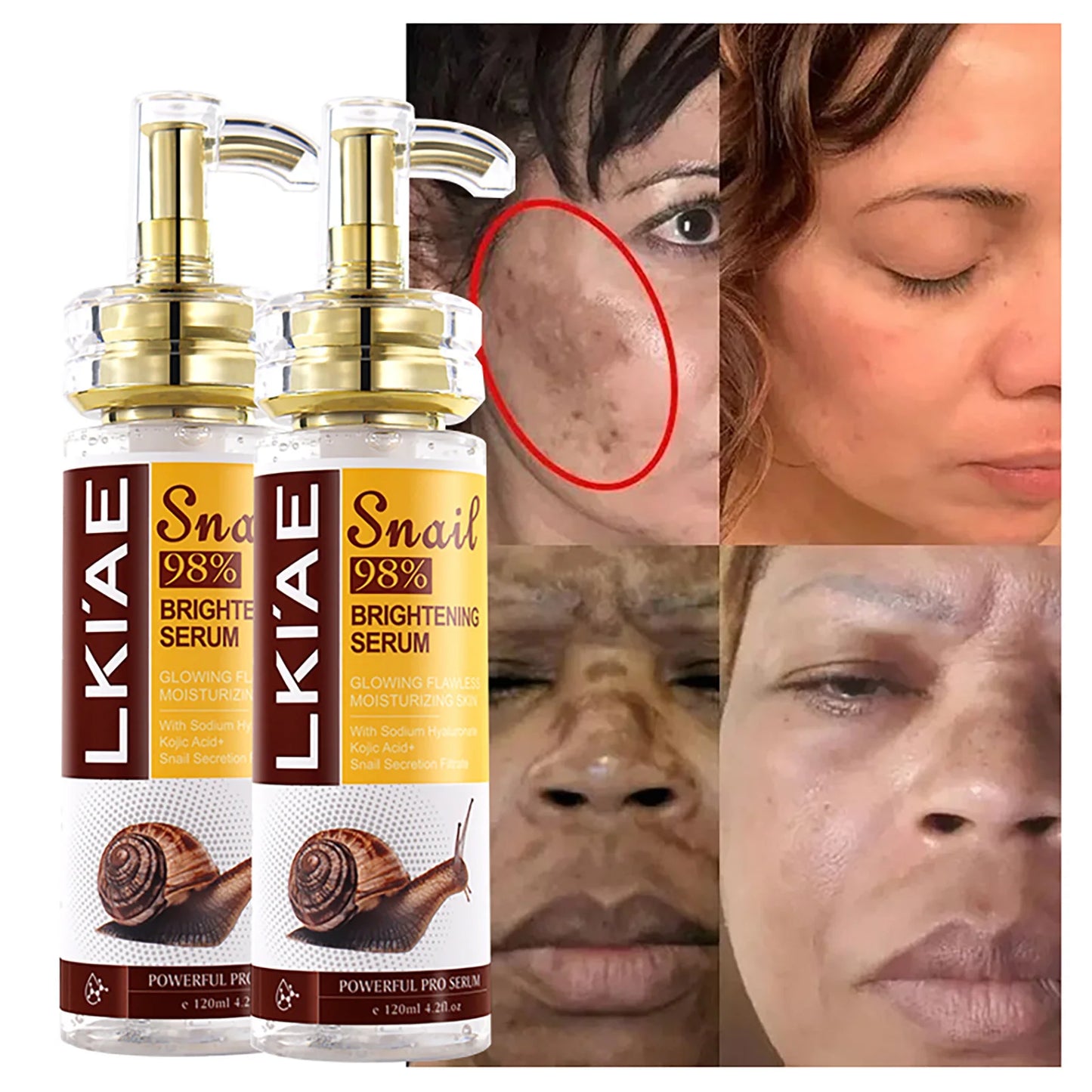 Snail 98 Face Serum Powerful 5 In 1