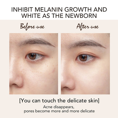 Brightening Face Serum, Blemish Remove Facial Serum