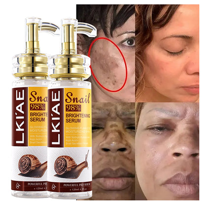 Snail 98 Face Serum Powerful 5 In 1